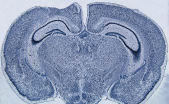 研究生物显微镜 DM4000/DM5000/DM5500/DM6000 B