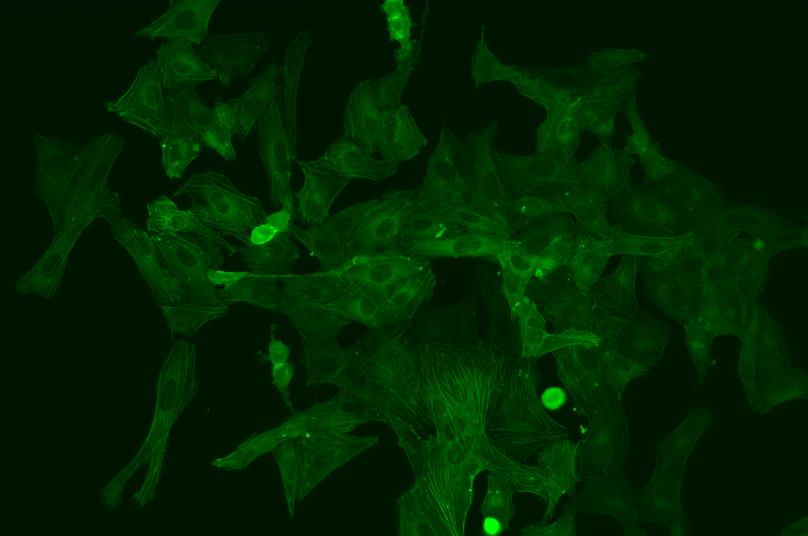 (U2OS细胞，GFP标记)放大倍率：20×，荧光观察