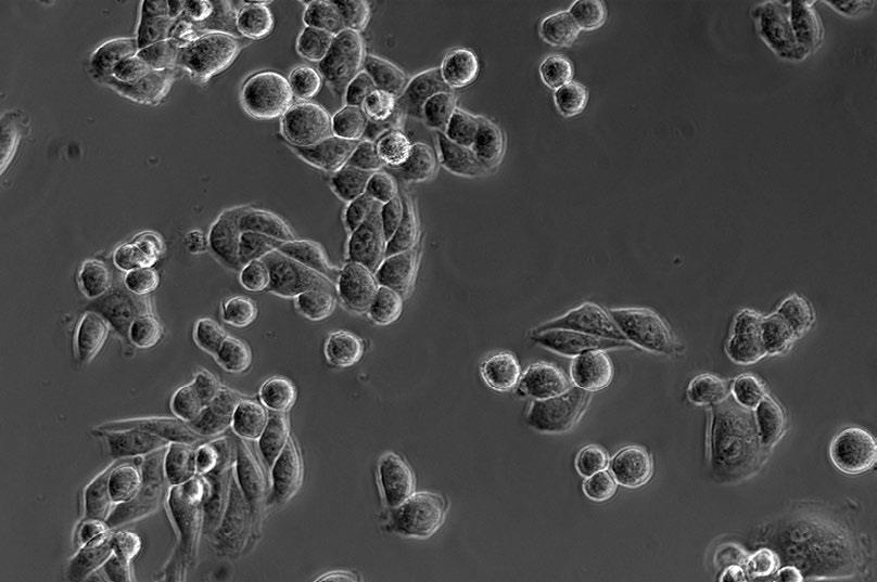 (海拉细胞)放大倍率：20×，相差