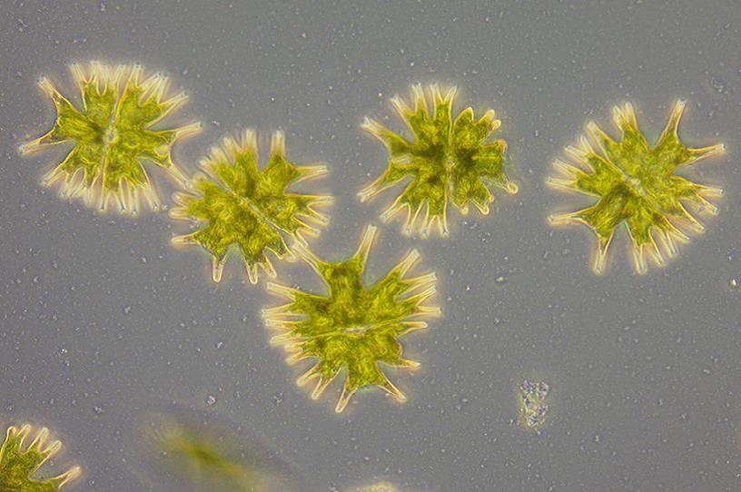 （辐射微星鼓藻）放大倍率：40×，相差